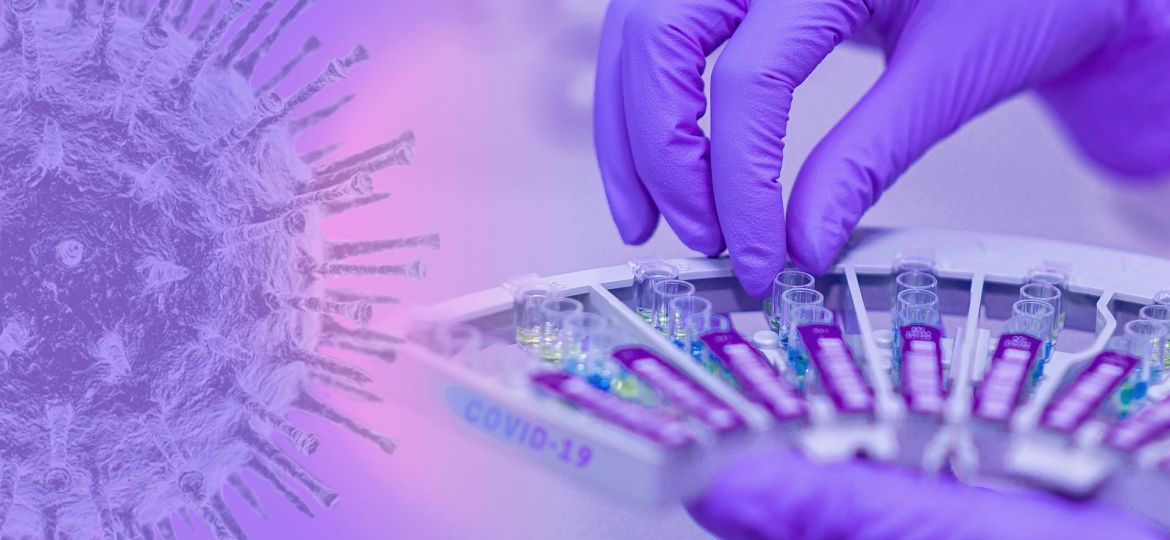 COLLABORATION-THE FUTURE OF AUDITS POST -COVID-19